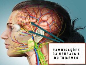 Pesquisadores da USP de São Carlos testam com sucesso tratamento para neuralgia do trigêmeo
