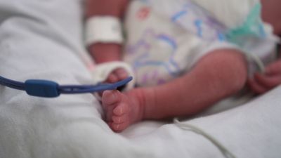 Maternidade da Santa Casa realiza com sucesso cesariana com histerectomia em caso raro de acretismo placentário