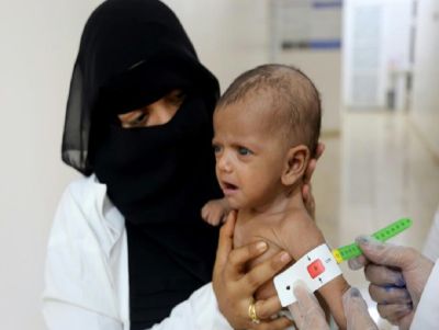 Enfermeiras examinam um bebê com desnutrição na província de Hodeida, no Iêmen, em 11 de março de 2023