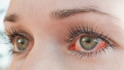 Luz verde pode ajudar a tratar infecções graves nos olhos