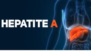 Casos de Hepatite A disparam em Ribeirão Preto e acendem alerta para vacinação