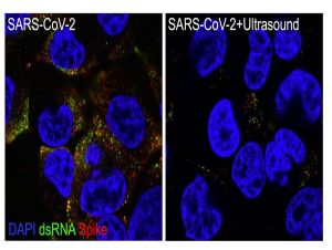 Cientistas da USP de São Carlos e Ribeirão Preto neutralizam o SARS-CoV-2 com ressonância acústica