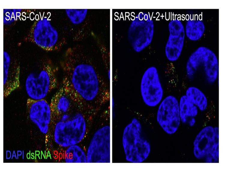 Cientistas da USP de São Carlos e Ribeirão Preto neutralizam o SARS-CoV-2 com ressonância acústica