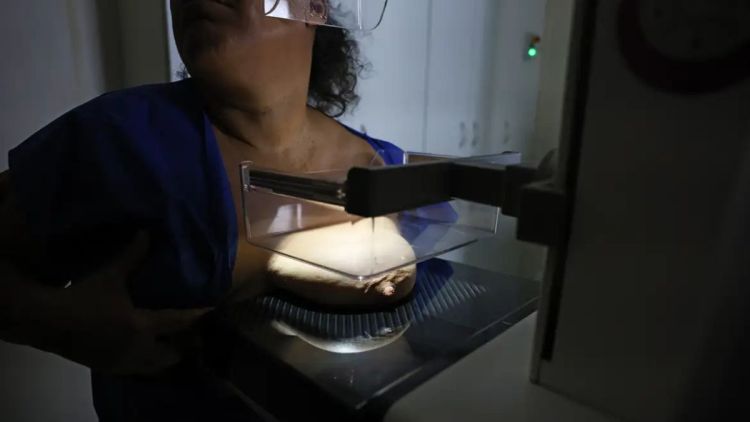 ANS defende que plano cubra mamografia digital sem restrição de idade