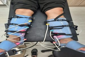 Lipedema: Chamada de pacientes voluntárias para novo tratamento